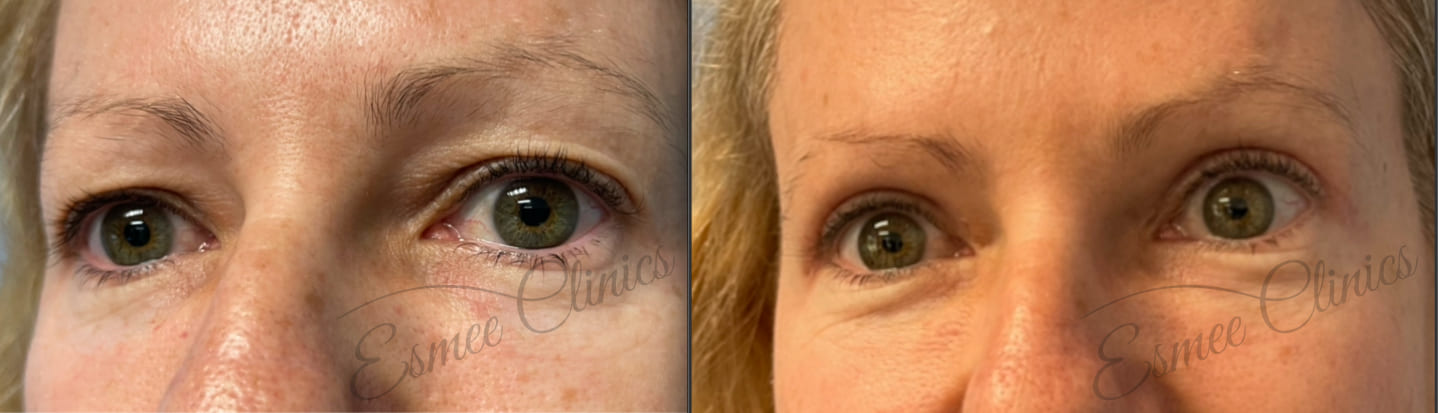 Before and After img